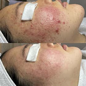 image-2