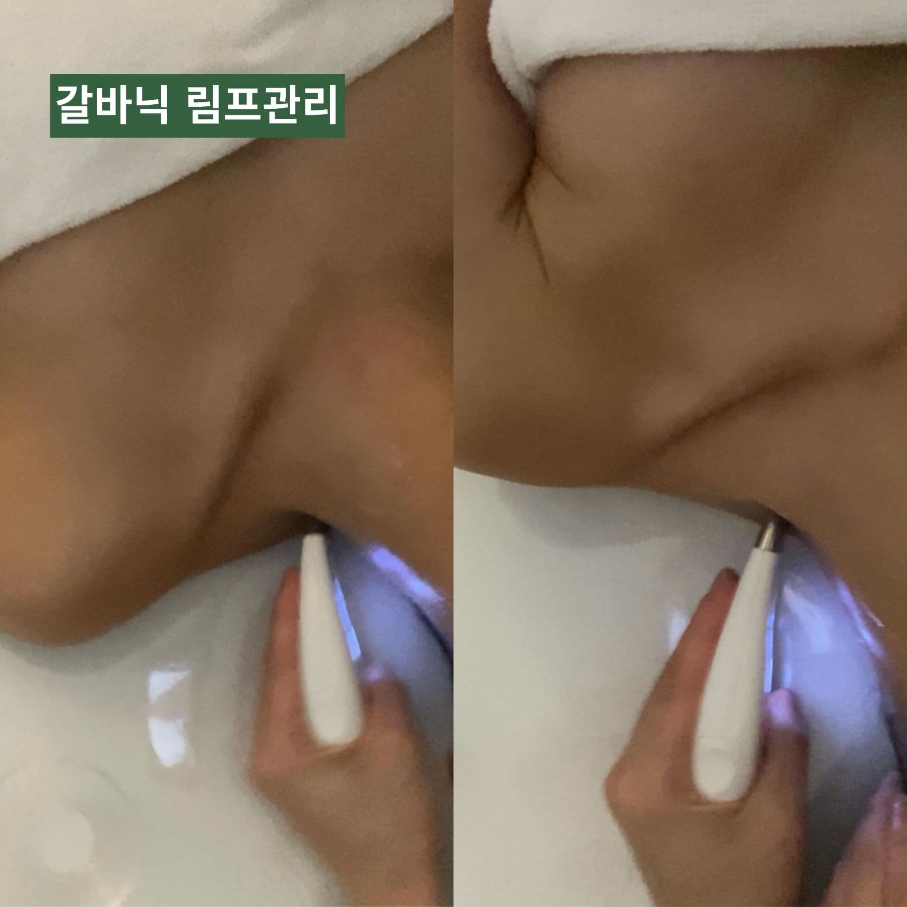 여우스킨 동탄점 - 네이버지도