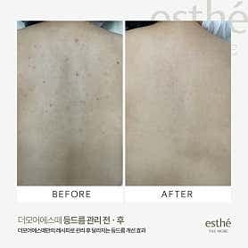 더모어뷰티 서면본점 - 네이버지도