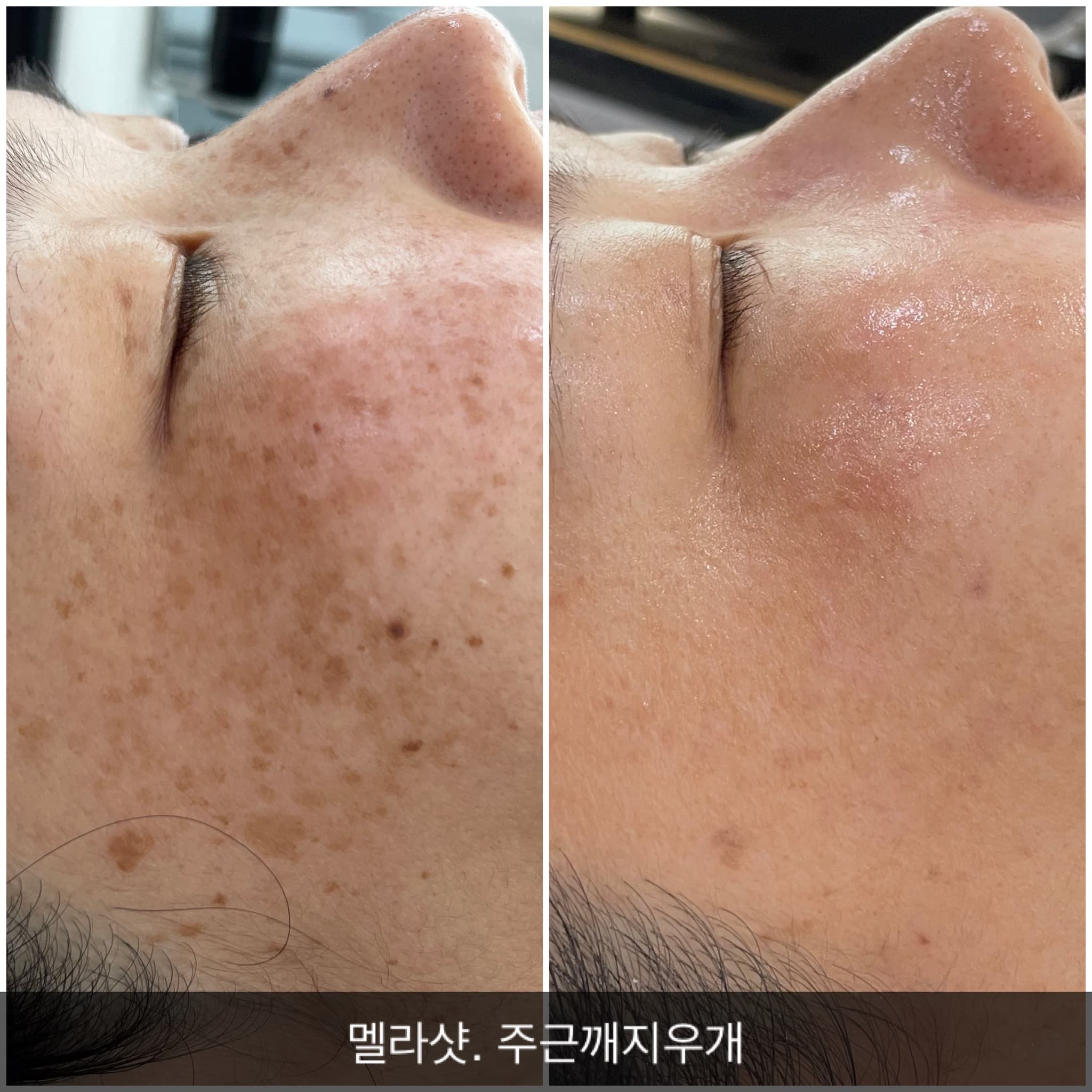써니뷰티 부천상동점